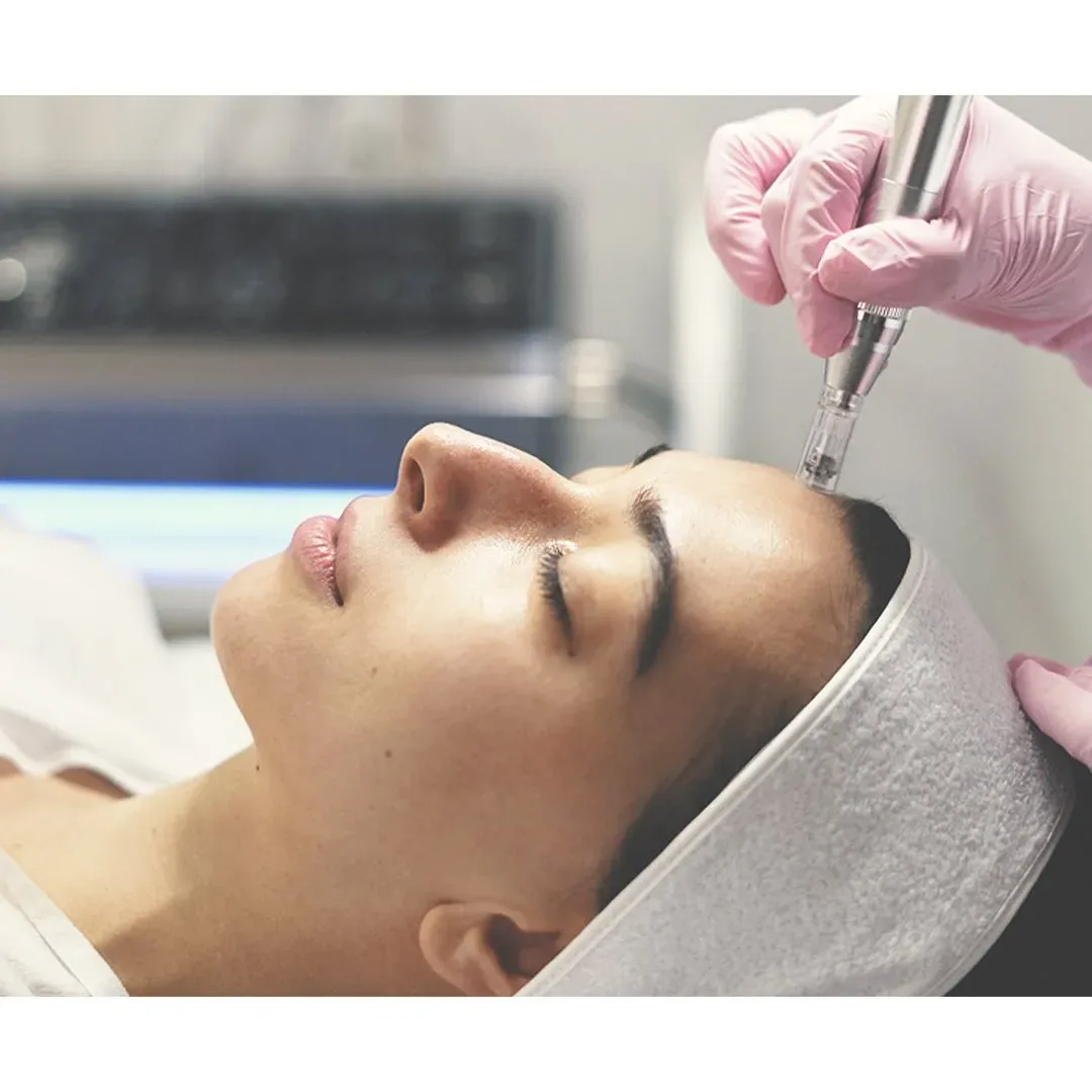 Dermapen con exosomas